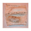 Bv Sterile Crepe Bandage 10cm x 5m - Double Wrapped - Box of 65